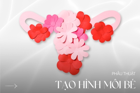 Phẫu thuật tạo hình môi bé